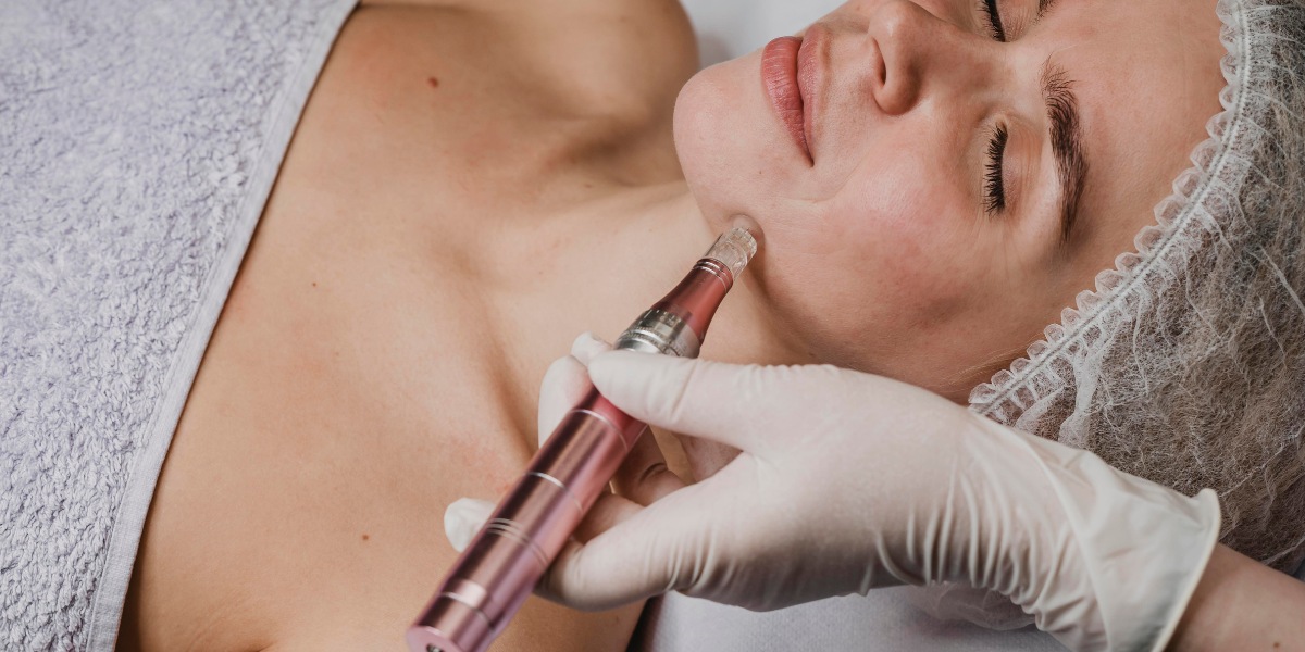 Microdermabrasion